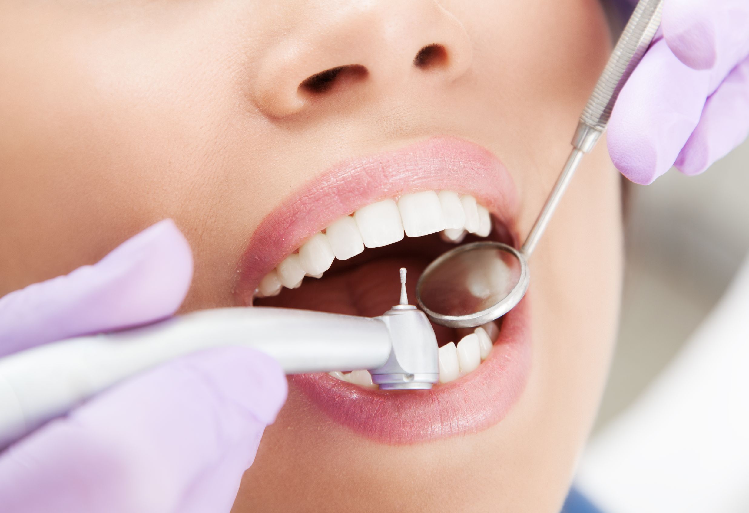 What You Should Expect When Getting Your Teeth Cleaned in Elk Grove Village