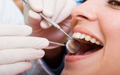 Transform Your Smile With a Cosmetic Dentist Miami Locals Trust for Stunning Results